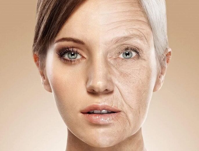 ansiktshud før og etter laserforyngelse